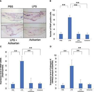 Azilsartan inhibits inflammation-triggered bone resorption and osteoclastogenesis in vivo via suppression of TNF-α expression in macrophages